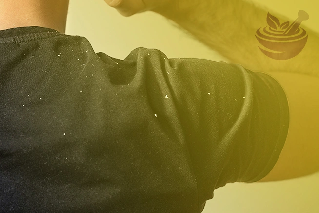 close-up back-view man with dandruff flakes on t-shirt